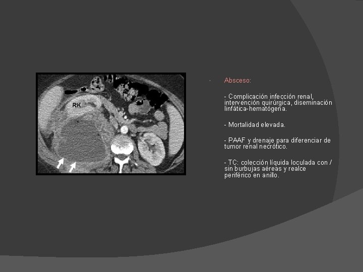 Absceso: - Complicación infección renal, intervención quirúrgica, diseminación linfática-hematógena. - Mortalidad elevada. - Absceso: - Complicación infección renal, intervención quirúrgica, diseminación linfática-hematógena. - Mortalidad elevada. -