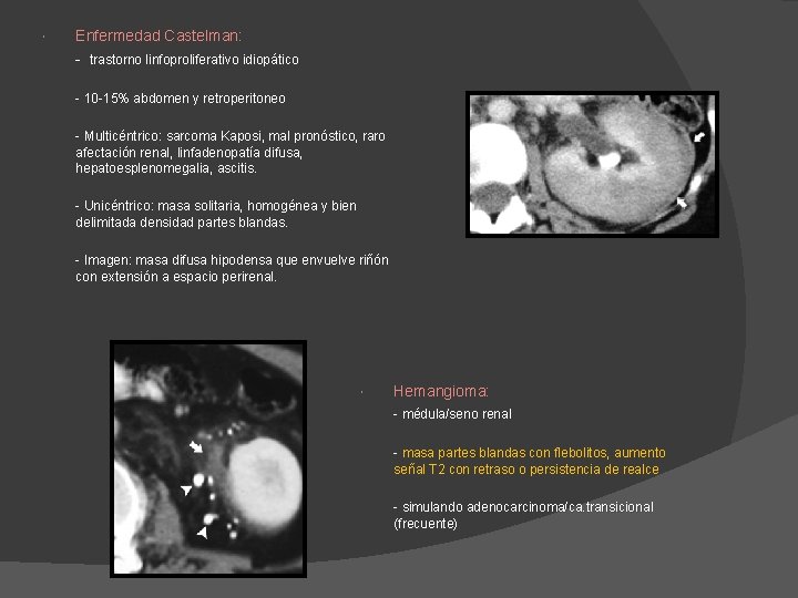 Enfermedad Castelman: - trastorno linfoproliferativo idiopático - 10 -15% abdomen y retroperitoneo - Enfermedad Castelman: - trastorno linfoproliferativo idiopático - 10 -15% abdomen y retroperitoneo -