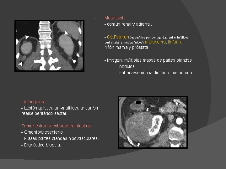 Metástasis: - común renal y adrenal. - Cá. Pulmón (específica por contiguidad entre Metástasis: - común renal y adrenal. - Cá. Pulmón (específica por contiguidad entre