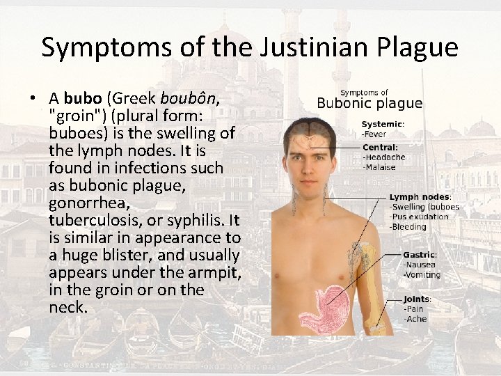 Symptoms of the Justinian Plague • A bubo (Greek boubôn, "groin") (plural form: buboes)