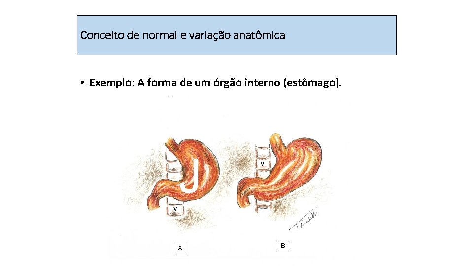 Conceito de normal e variação anatômica • Exemplo: A forma de um órgão interno