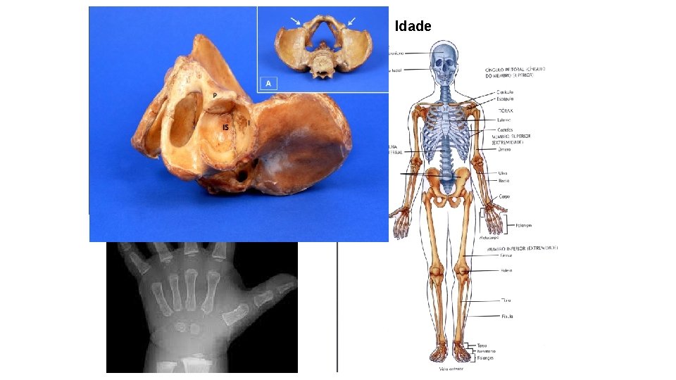 Idade 