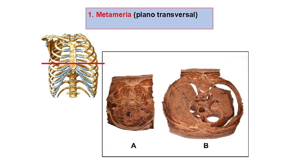 1. Metameria (plano transversal) 