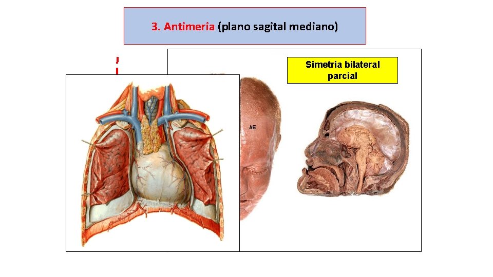 3. Antimeria (plano sagital mediano) Simetria bilateral parcial 
