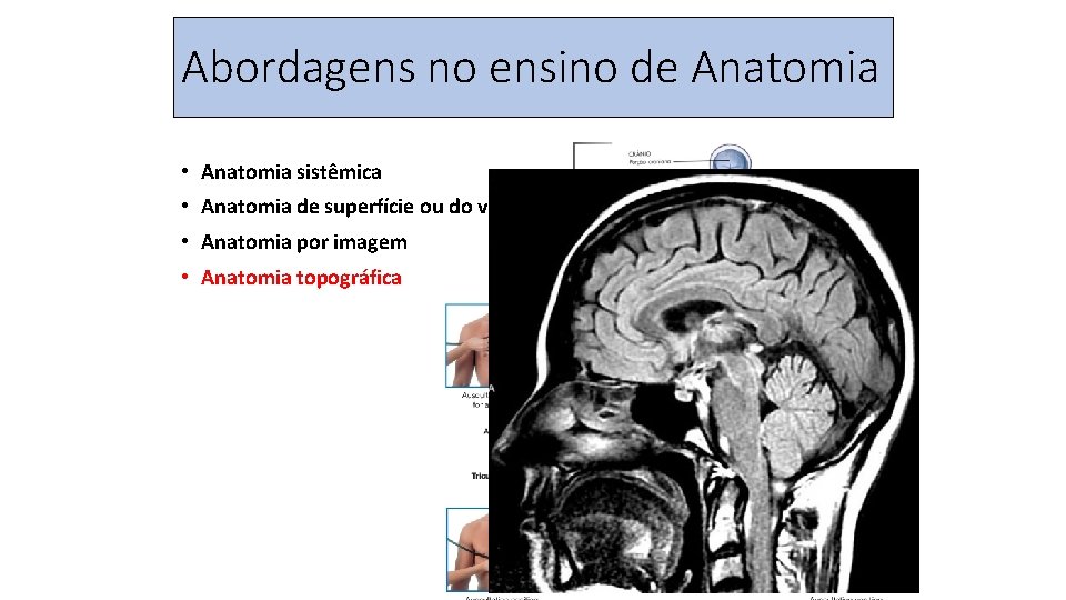Abordagens no ensino de Anatomia • Anatomia sistêmica • Anatomia de superfície ou do