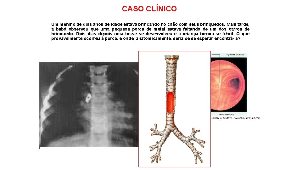 CASO CLÍNICO Um menino de dois anos de idade estava brincando no chão com