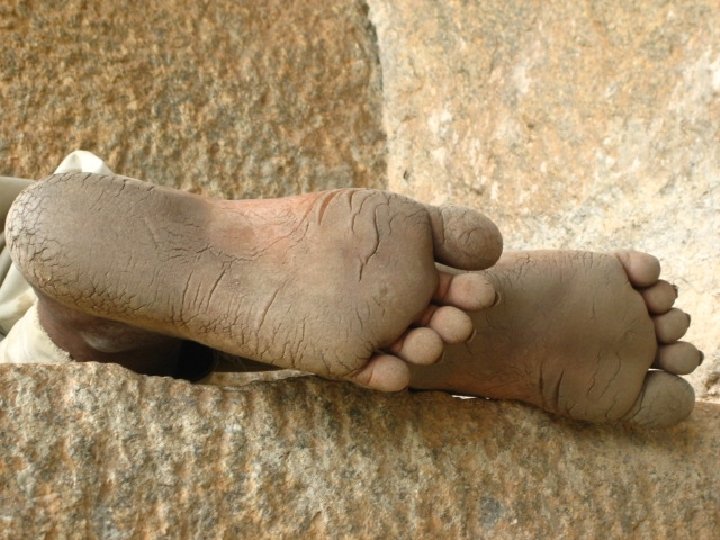 Dirty Feet Chinese 