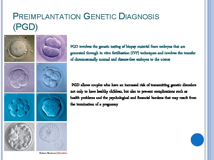 PREIMPLANTATION GENETIC DIAGNOSIS (PGD) PGD involves the genetic testing of biopsy material from embryos