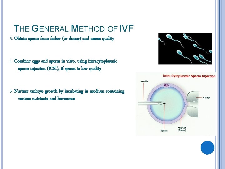 THE GENERAL METHOD OF IVF 3. Obtain sperm from father (or donor) and assess