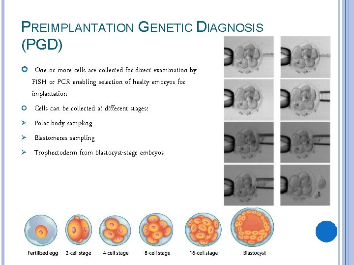 PREIMPLANTATION GENETIC DIAGNOSIS (PGD) One or more cells are collected for direct examination by