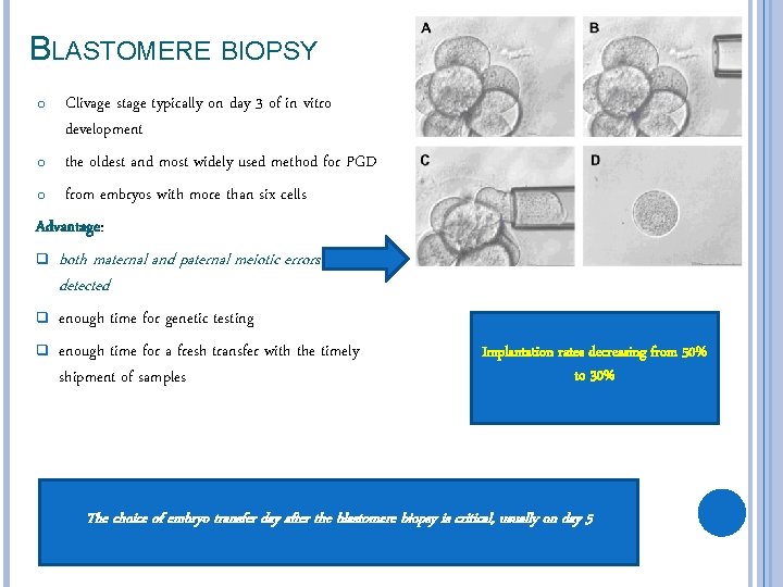 BLASTOMERE BIOPSY Clivage stage typically on day 3 of in vitro development o the