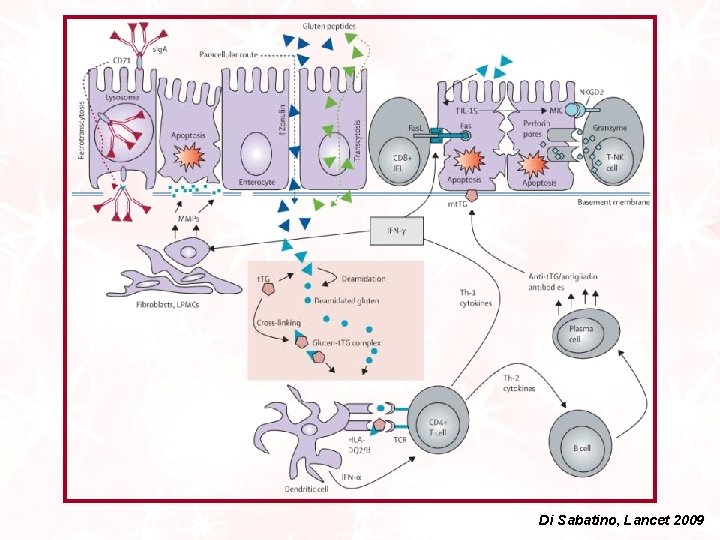 Di Sabatino, Lancet 2009 