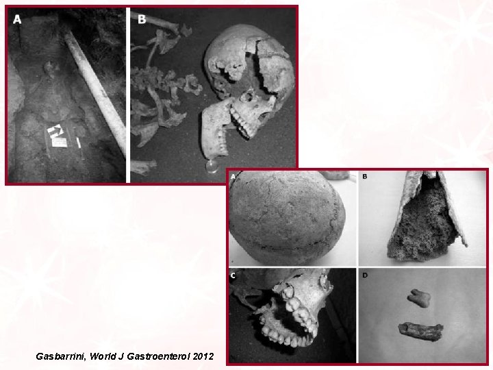 Gasbarrini, World J Gastroenterol 2012 