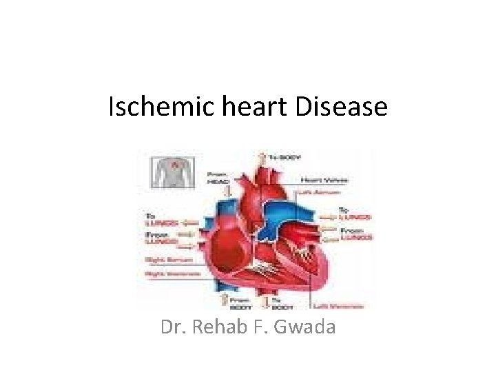 Ischemic heart Disease Dr. Rehab F. Gwada 