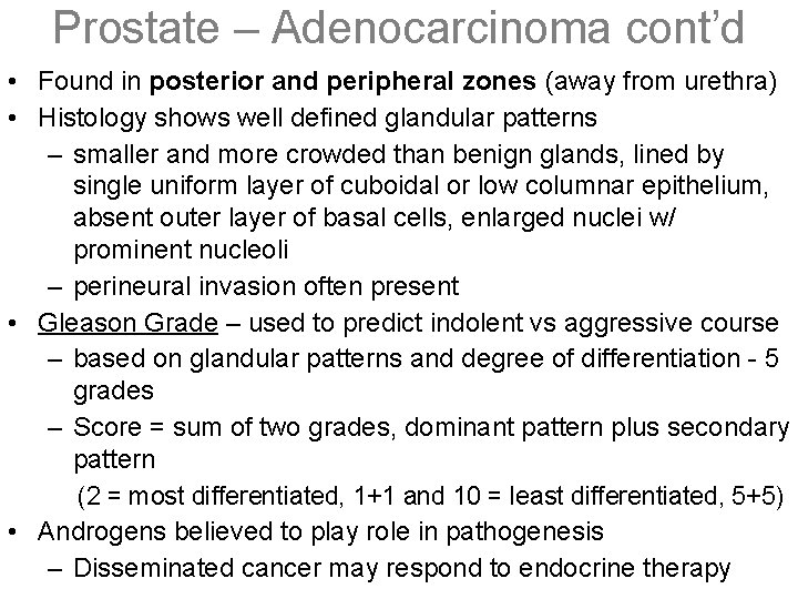 Prostate – Adenocarcinoma cont’d • Found in posterior and peripheral zones (away from urethra)