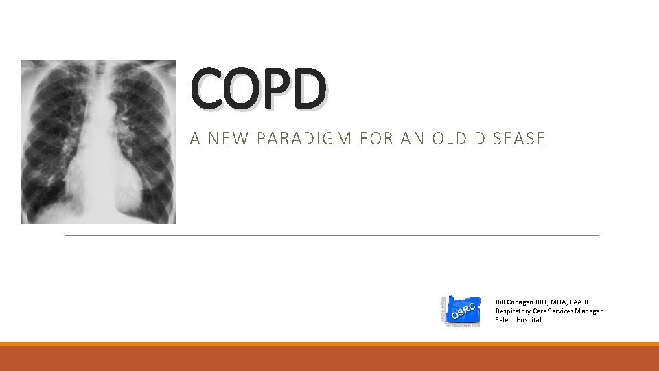 COPD A NEW PARADIGM FOR AN OLD DISEASE Bill Cohagen RRT, MHA, FAARC Respiratory