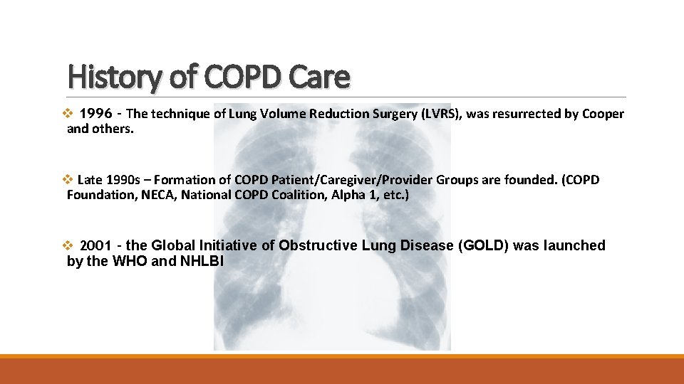 History of COPD Care v 1996 - The technique of Lung Volume Reduction Surgery