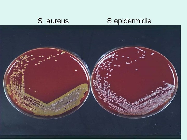S. aureus S. epidermidis S. aureus S. epidermidis