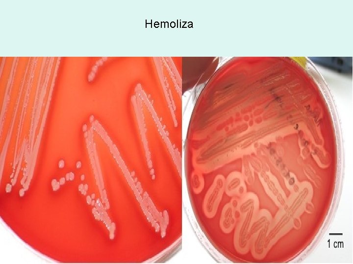 Hemoliza Hemoliza