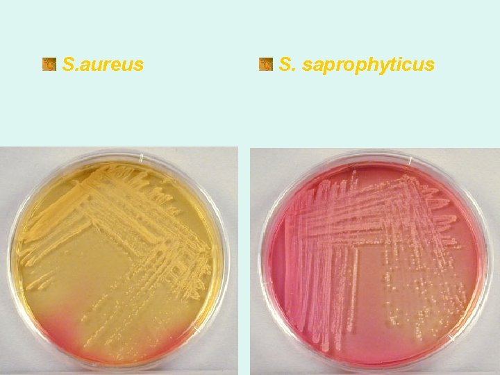 S. aureus S. saprophyticus S. aureus S. saprophyticus