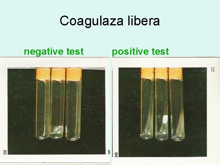 Coagulaza libera negative test positive test Coagulaza libera negative test positive test