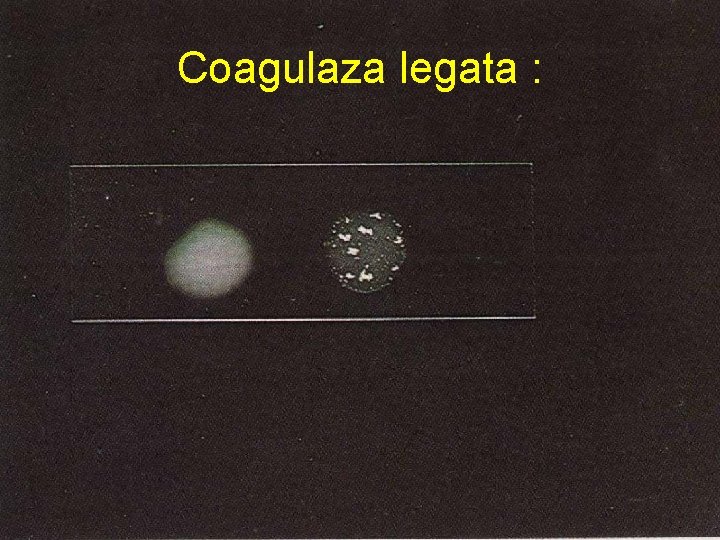 Coagulaza legata : Coagulaza legata :