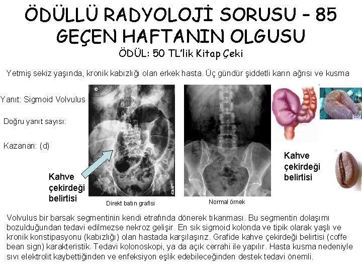 ÖDÜLLÜ RADYOLOJİ SORUSU – 85 GEÇEN HAFTANIN OLGUSU ÖDÜL: 50 TL’lik Kitap Çeki Yetmiş