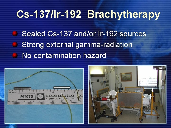 Cs-137/Ir-192 Brachytherapy Sealed Cs-137 and/or Ir-192 sources Strong external gamma-radiation No contamination hazard 
