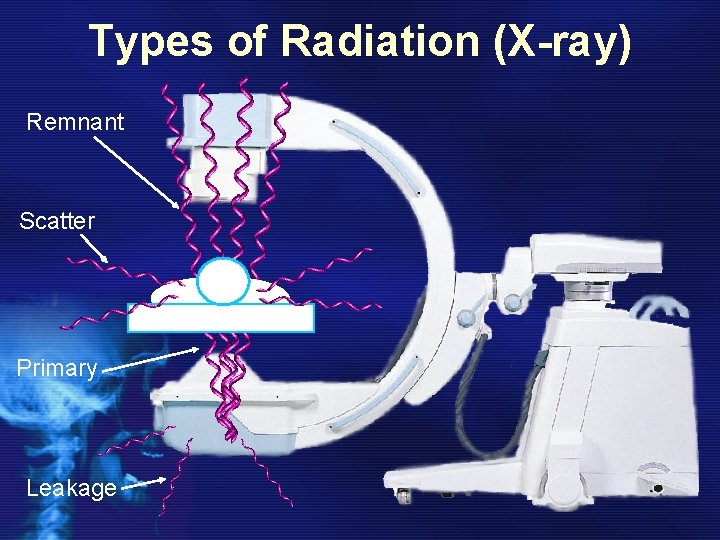Types of Radiation (X-ray) Remnant Scatter Primary Leakage 