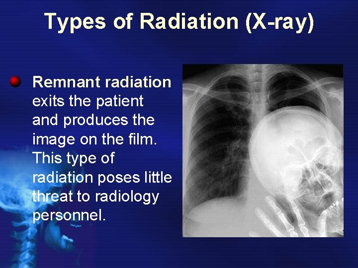 Types of Radiation (X-ray) Remnant radiation exits the patient and produces the image on