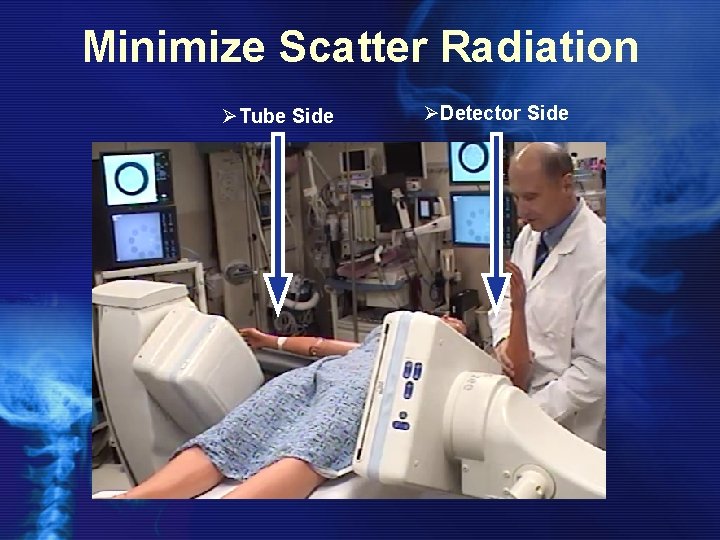 Minimize Scatter Radiation ØTube Side ØDetector Side 