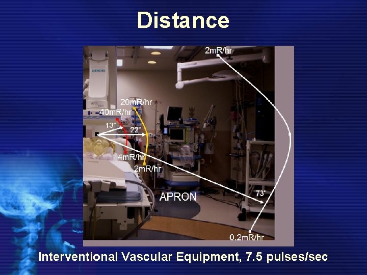 Distance Interventional Vascular Equipment, 7. 5 pulses/sec 