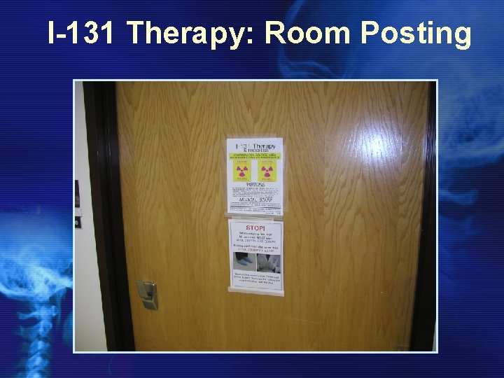 I-131 Therapy: Room Posting 