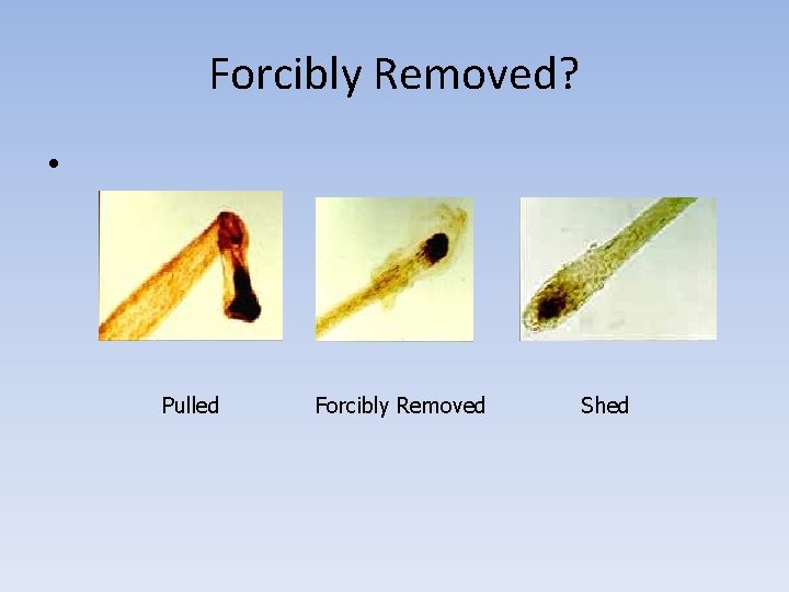 Forcibly Removed? • Pulled Forcibly Removed Shed 