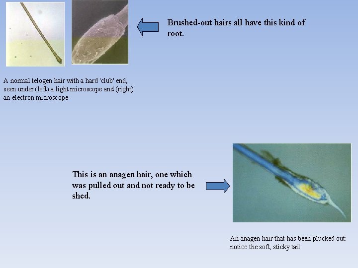 Brushed-out hairs all have this kind of root. A normal telogen hair with a