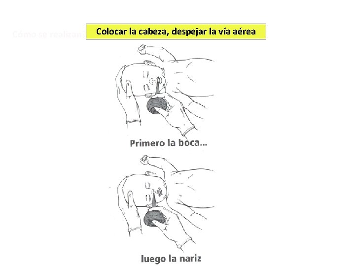 Cómo se realizan? Colocar la cabeza, despejar la vía aérea 