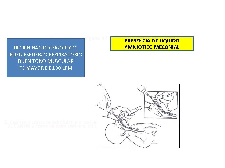 1. Proporcionar oxígeno a flujo libre PRESENCIA DE LIQUIDO RECIEN NACIDO VIGOROSO: BUEN ESFUERZO