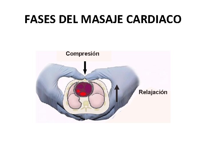 FASES DEL MASAJE CARDIACO 