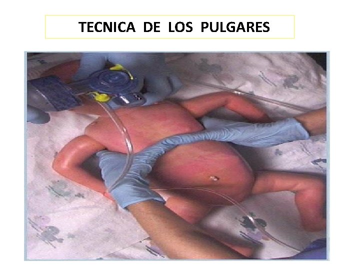 TECNICA DE LOS PULGARES 