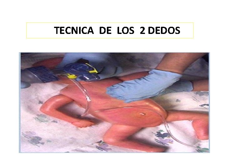 TECNICA DE LOS 2 DEDOS 