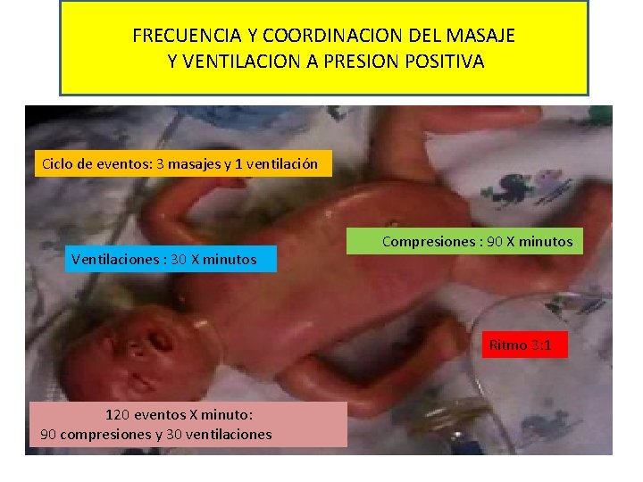 FRECUENCIA Y COORDINACION DEL MASAJE Y VENTILACION A PRESION POSITIVA Ciclo de eventos: 3