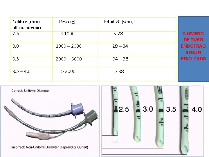 Calibre (mm) Peso (g) Edad G. (sem) 2. 5 < 1000 < 28 3.