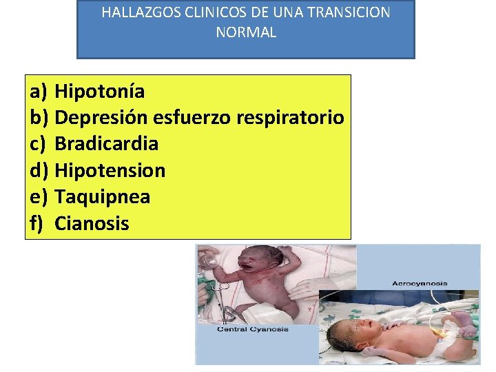 HALLAZGOS CLINICOS DE UNA TRANSICION NORMAL a) Hipotonía b) Depresión esfuerzo respiratorio c) Bradicardia