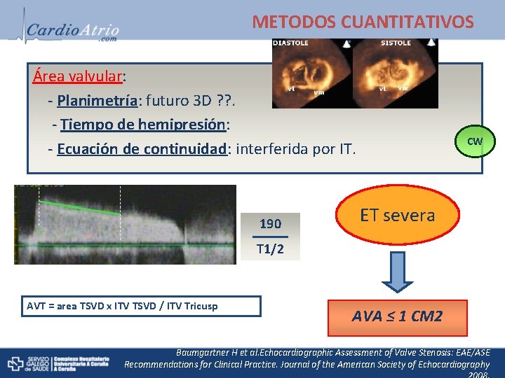 METODOS CUANTITATIVOS Área valvular: - Planimetría: futuro 3 D ? ? . - Tiempo
