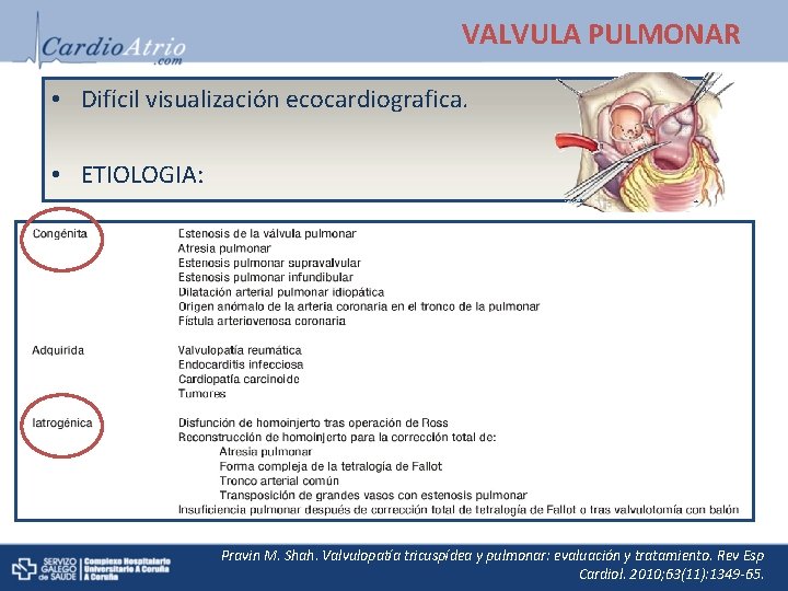 VALVULA PULMONAR • Difícil visualización ecocardiografica. • ETIOLOGIA: Pravin M. Shah. Valvulopatía tricuspídea y