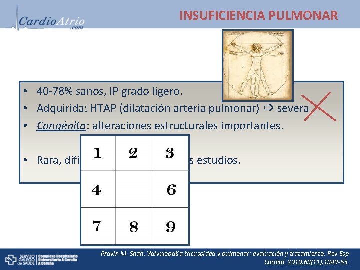 INSUFICIENCIA PULMONAR • 40 -78% sanos, IP grado ligero. • Adquirida: HTAP (dilatación arteria