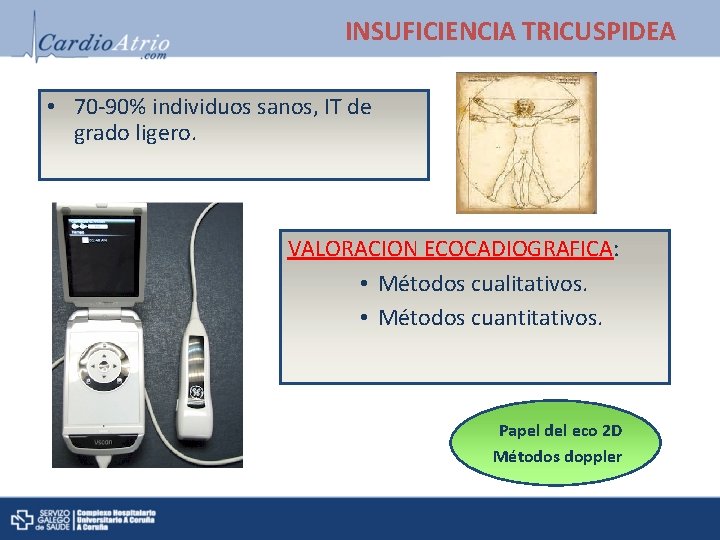 INSUFICIENCIA TRICUSPIDEA • 70 -90% individuos sanos, IT de grado ligero. VALORACION ECOCADIOGRAFICA: •
