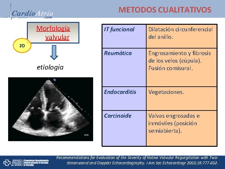 METODOS CUALITATIVOS Morfología valvular IT funcional Dilatación circunferencial del anillo. Reumática Engrosamiento y fibrosis