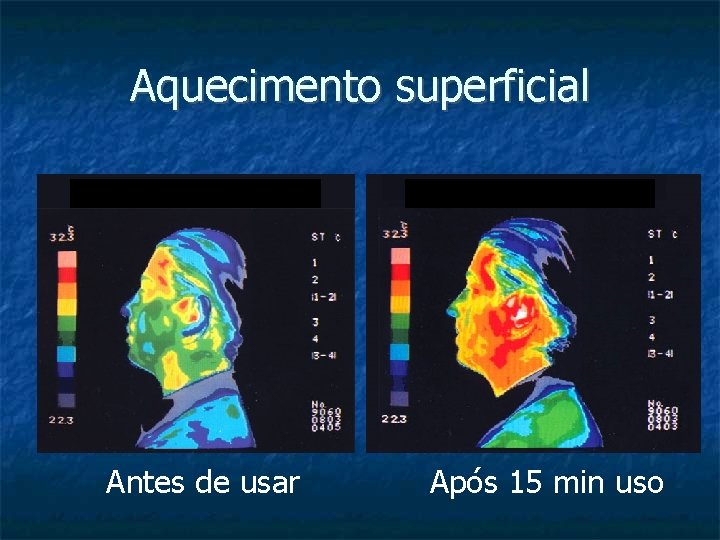 Aquecimento superficial Antes de usar Após 15 min uso 