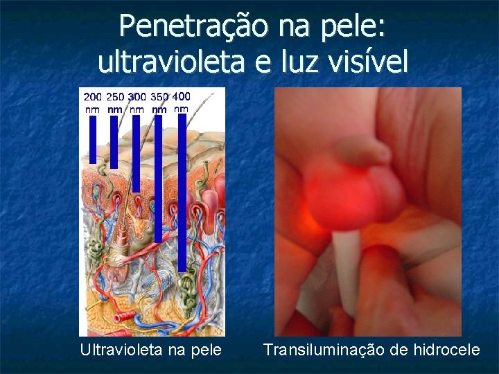 Penetração na pele: ultravioleta e luz visível Ultravioleta na pele Transiluminação de hidrocele 